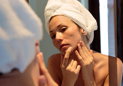 woman with skin problems looking in mirror